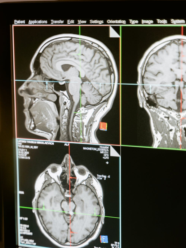Diagnosing and Analyzing